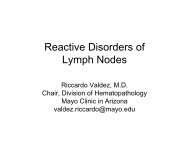 Reactive Disorders of Lymph Nodes - Pathology
