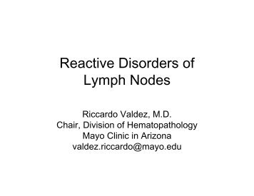 Reactive Disorders of Lymph Nodes - Pathology
