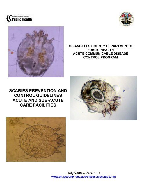 Scabies Prevention and Control Guidelines Acute - Department of