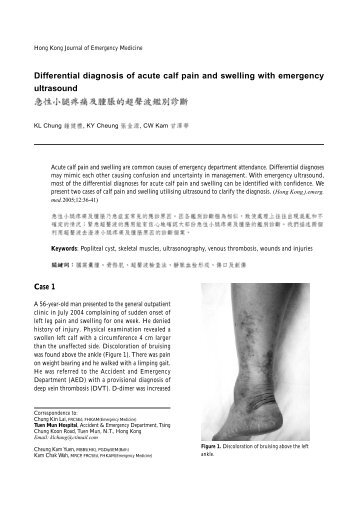 Differential diagnosis of acute calf pain and swelling - Hong Kong ...