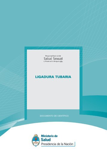 ligadura_tubaria