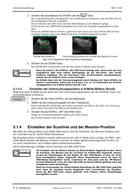 SDU-1100 - Sonowied GmbH