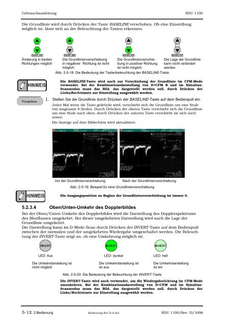 SDU-1100 - Sonowied GmbH