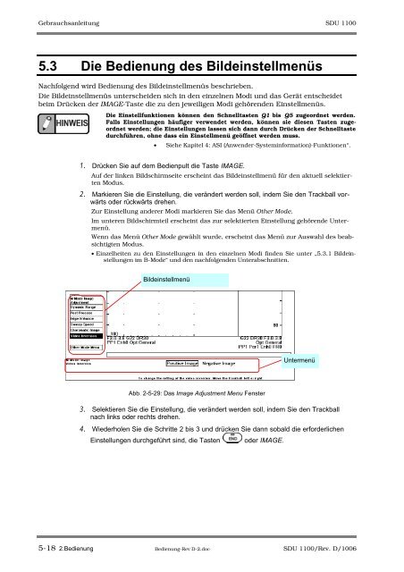 SDU-1100 - Sonowied GmbH