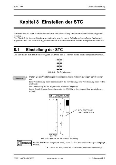 SDU-1100 - Sonowied GmbH