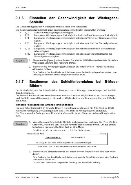 SDU-1100 - Sonowied GmbH