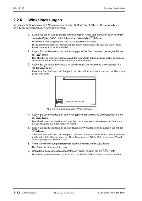 SDU-1100 - Sonowied GmbH