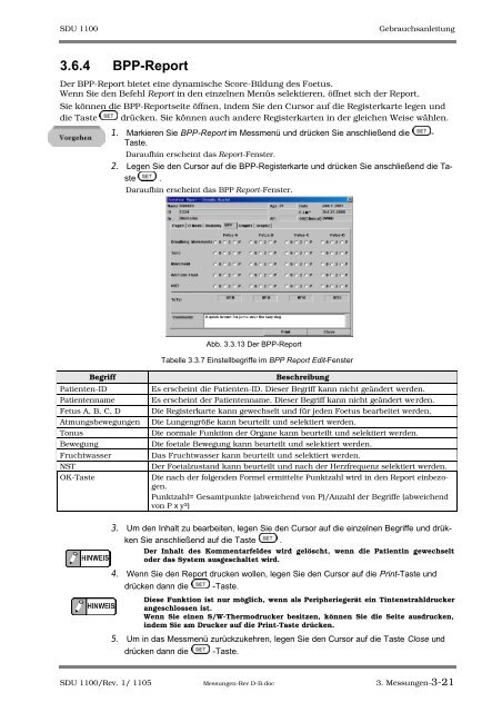 SDU-1100 - Sonowied GmbH