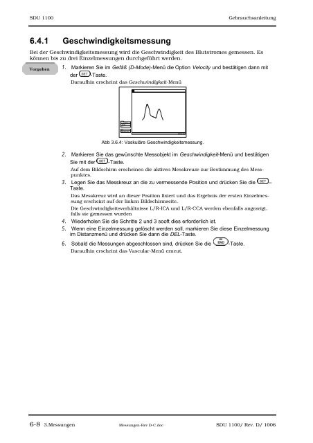 SDU-1100 - Sonowied GmbH