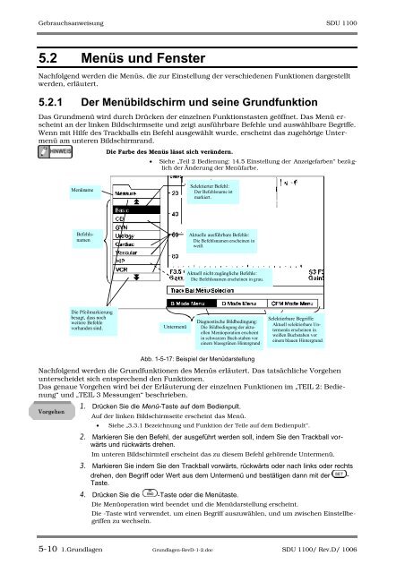 SDU-1100 - Sonowied GmbH