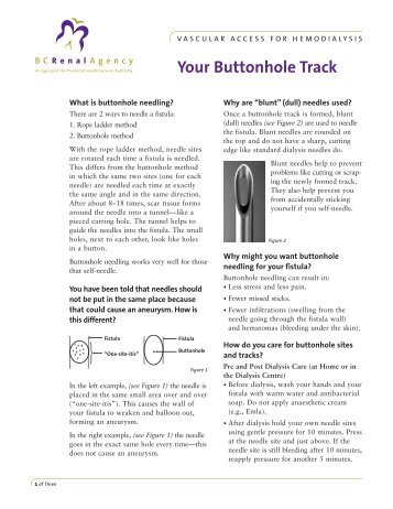 Buttonhole Cannulation - Your Buttonhole Track - BC Provincial ...