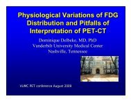 Physiological Variations of FDG Distribution and Pitfalls of ...