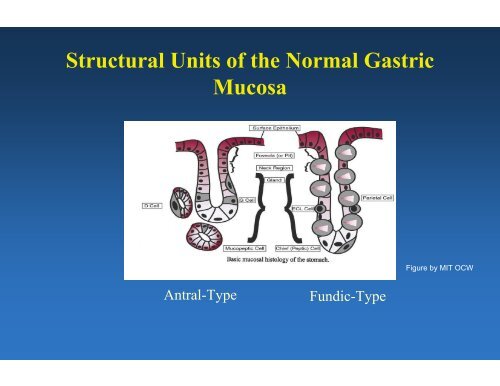 Overview of Gastric Pathology: Non-Neoplastic Diseases