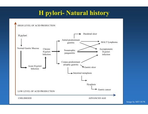 Overview of Gastric Pathology: Non-Neoplastic Diseases