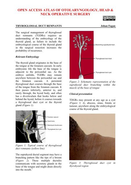 thyroglossal duct remnants - Vula - University of Cape Town