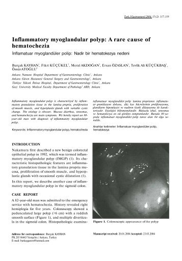 Inflammatory myoglandular polyp: A rare cause of hematochezia