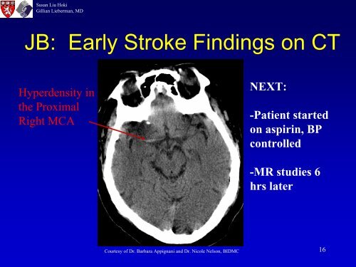 Diagnosis of Acute Ischemic Stroke