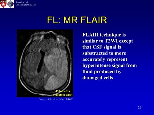 Diagnosis of Acute Ischemic Stroke