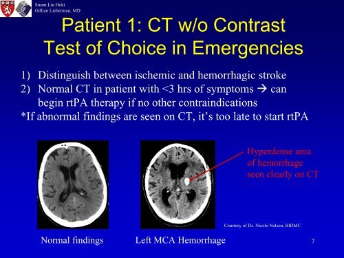 Diagnosis of Acute Ischemic Stroke