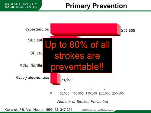 Stroke Prevention and Treatment - Rush University Medical Center