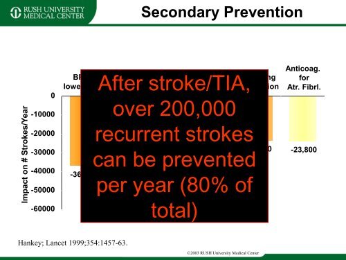 Stroke Prevention and Treatment - Rush University Medical Center