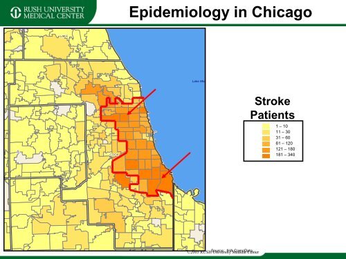 Stroke Prevention and Treatment - Rush University Medical Center