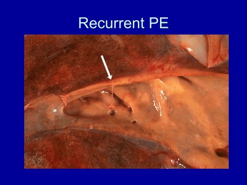 Diseases of the Lung and Respiratory Tract Part