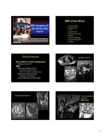MRI of the Wrist and Hand
