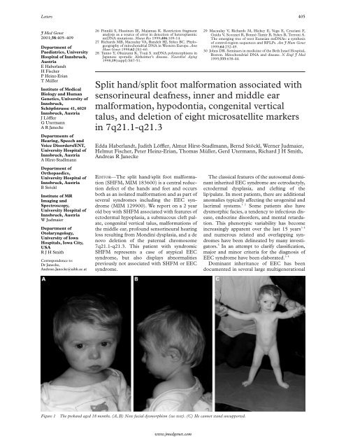 Split hand/split foot malformation associated with sensorineural ...