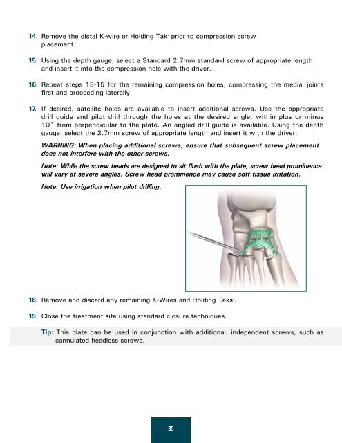 Table of Contents - OsteoMed