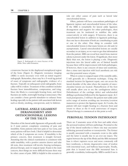 lateral pain syndromes of the foot and ankle - The Podiatry Institute