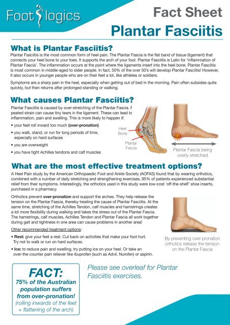 Plantar Fasciitis - Footlogics Orthotics