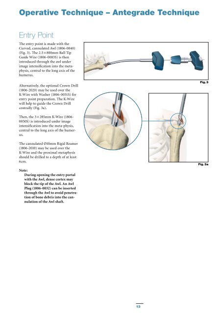 T2 Humeral Nailing System Operative Technique - Stryker