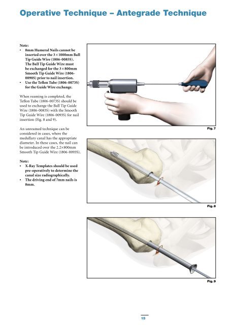 T2 Humeral Nailing System Operative Technique - Stryker