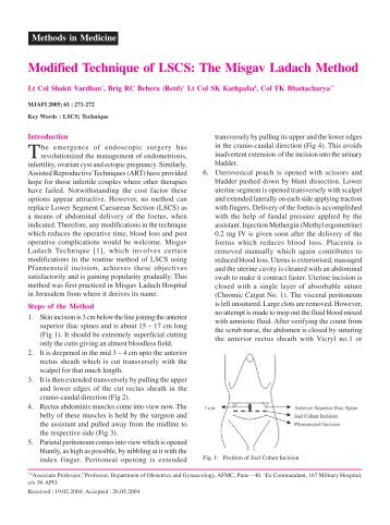 Modified Technique of LSCS: The Misgav Ladach Method - medIND