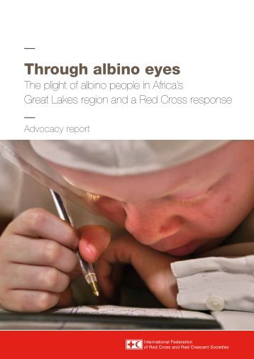 Through albino eyes - International Federation of Red Cross and ...