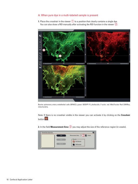 Dye Separation - Leica Microsystems