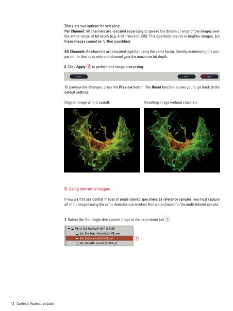 Dye Separation - Leica Microsystems