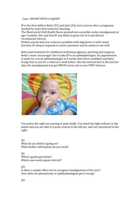 Infant With A Squint The Private Eye Clinic