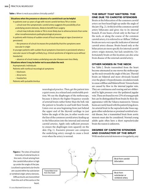 The carotid bruit - Practical Neurology