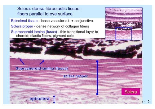 Sclera