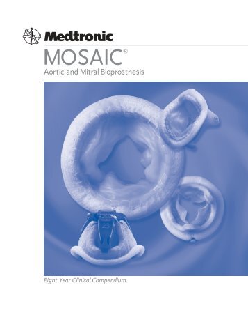 Mosaic Bioprosthesis 8 Year Clinical Compendium - Medtronic