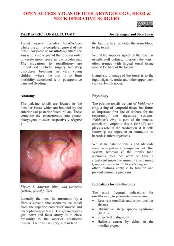 Paediatric tonsillectomy - Vula - University of Cape Town