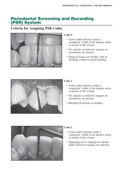 Periodontal Screening And Recording Chart