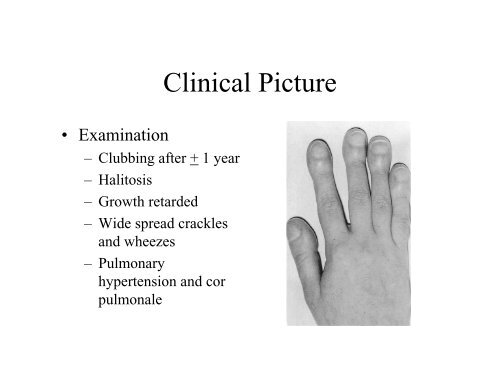 Recurrent or Persistent Pneumonia