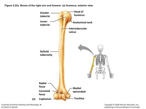 bone Medullary cavity Diaphysis Distal epiphysis