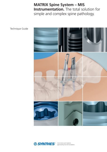 MATRIX Spine System – MIS Instrumentation. The total ... - Synthes