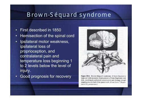 Spine and Spinal cord injury - Mahidol University