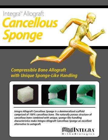 Integra OrthoBiologics Allograft Cancellous Sponge