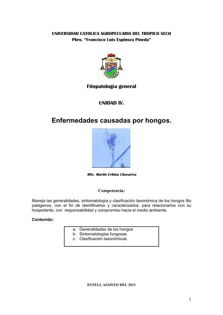 Enfermedades causadas por hongos. - Martín Urbina Chavarría